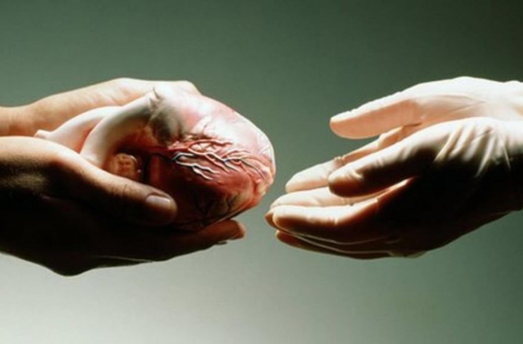 heart transplant
