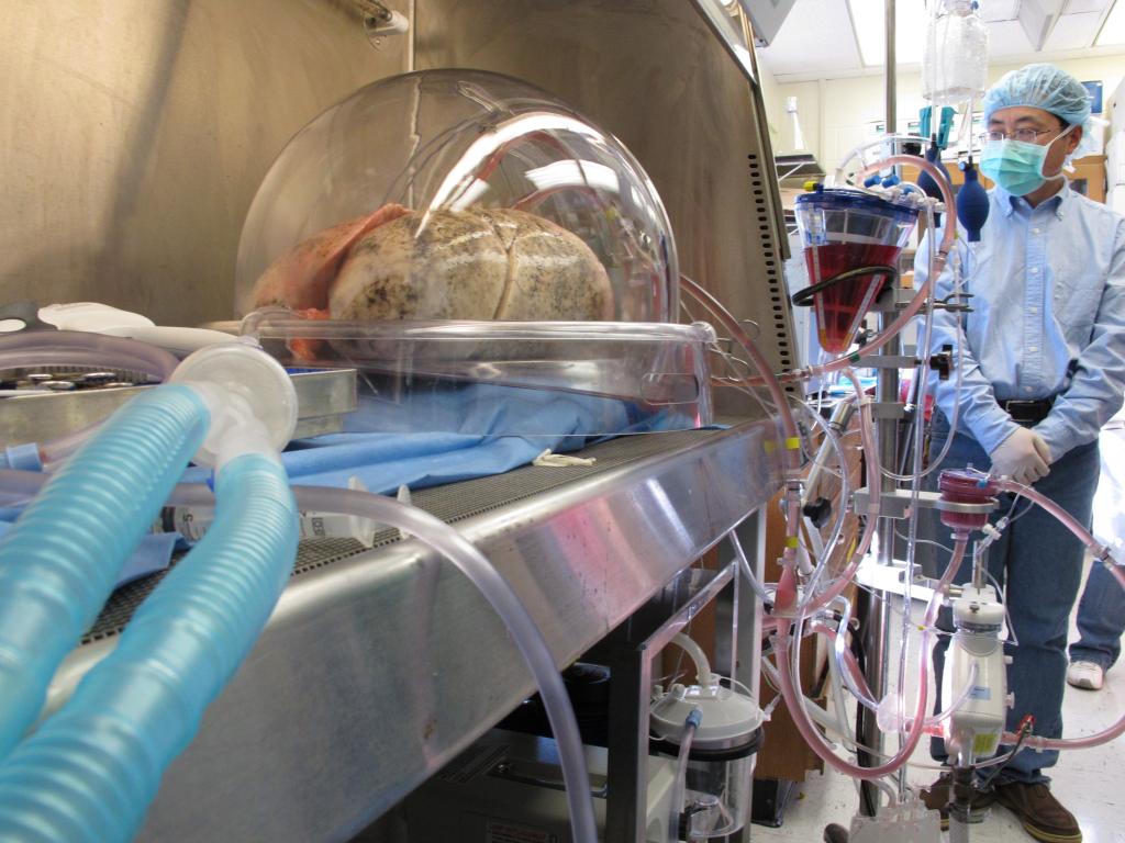 transplant operation