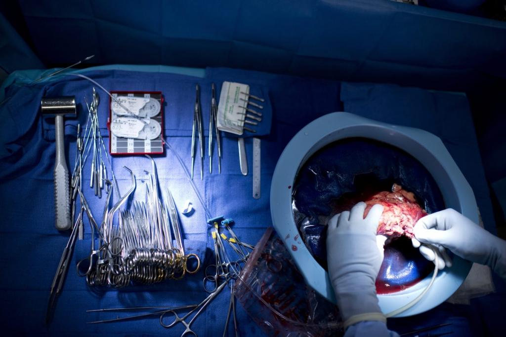 organ transplant preparation