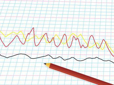 income and economic profit