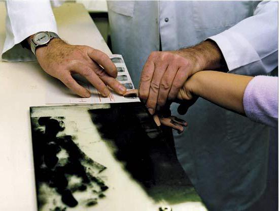 legal representative of a minor suspect