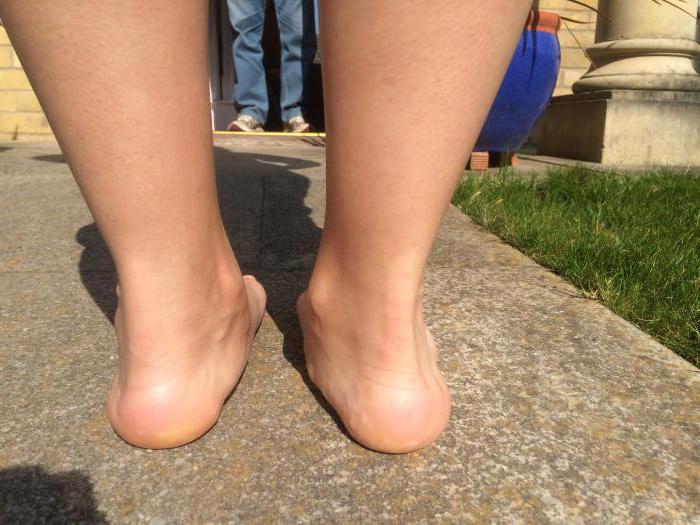 with a 3 degree platypodia take into the army