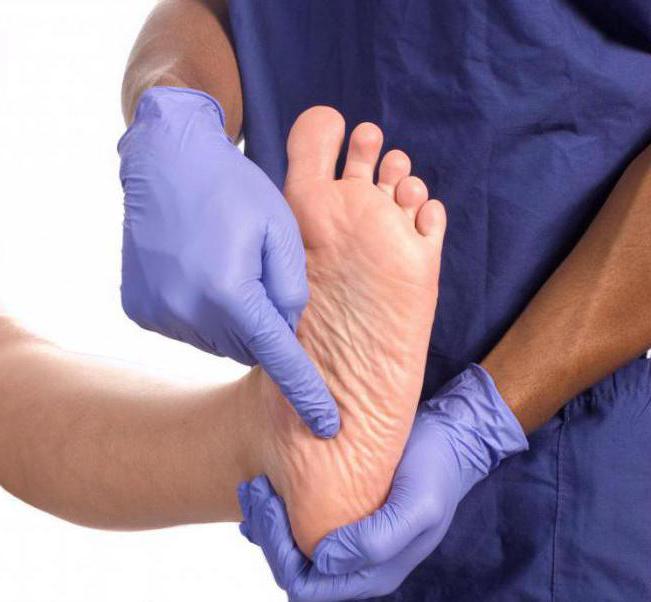 flat feet 3 degrees cure