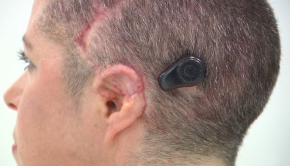 How to choose a hearing aid price?