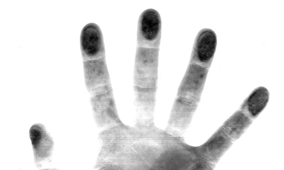 types of forensic examinations