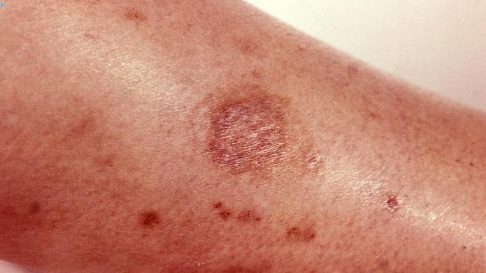 GOST Chemical Hazard Class