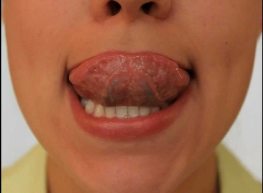 how to open your speech therapy room