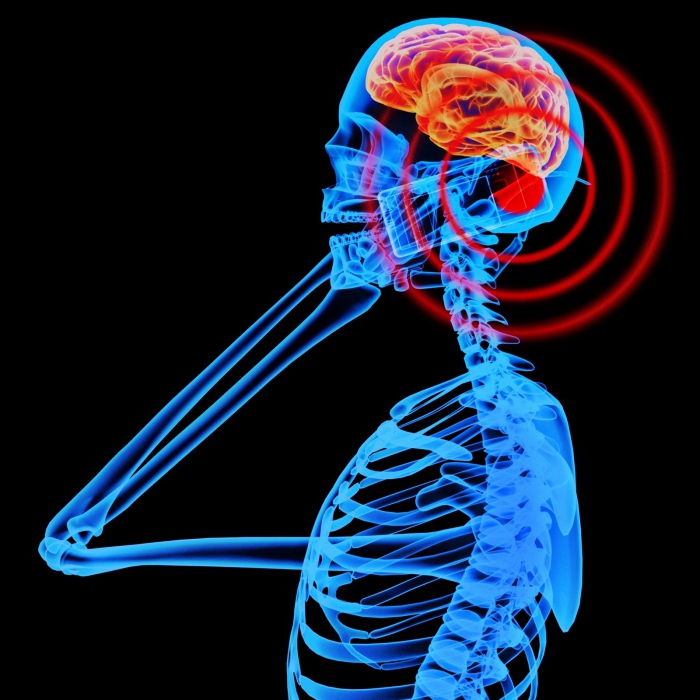 Radiation level, norm