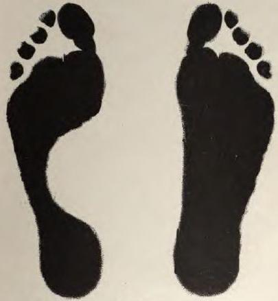 whether they take into the army with flat feet 3