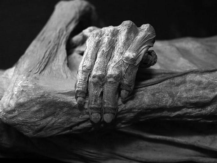 early and late signs of biological death