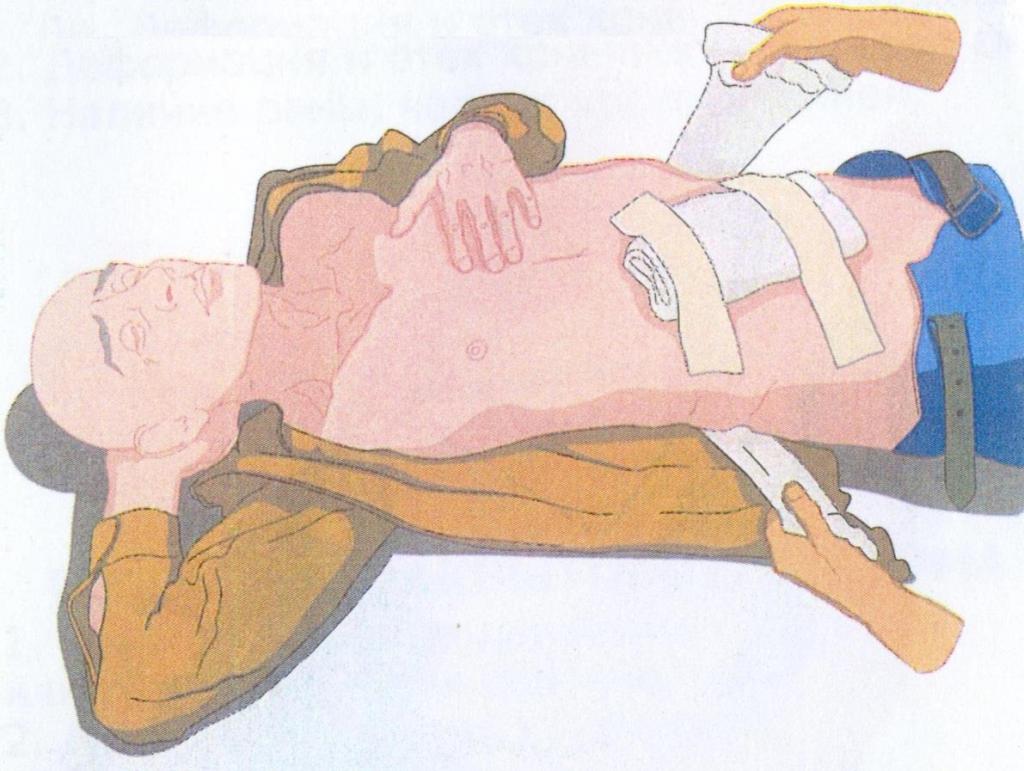 help with a knife wound in the stomach