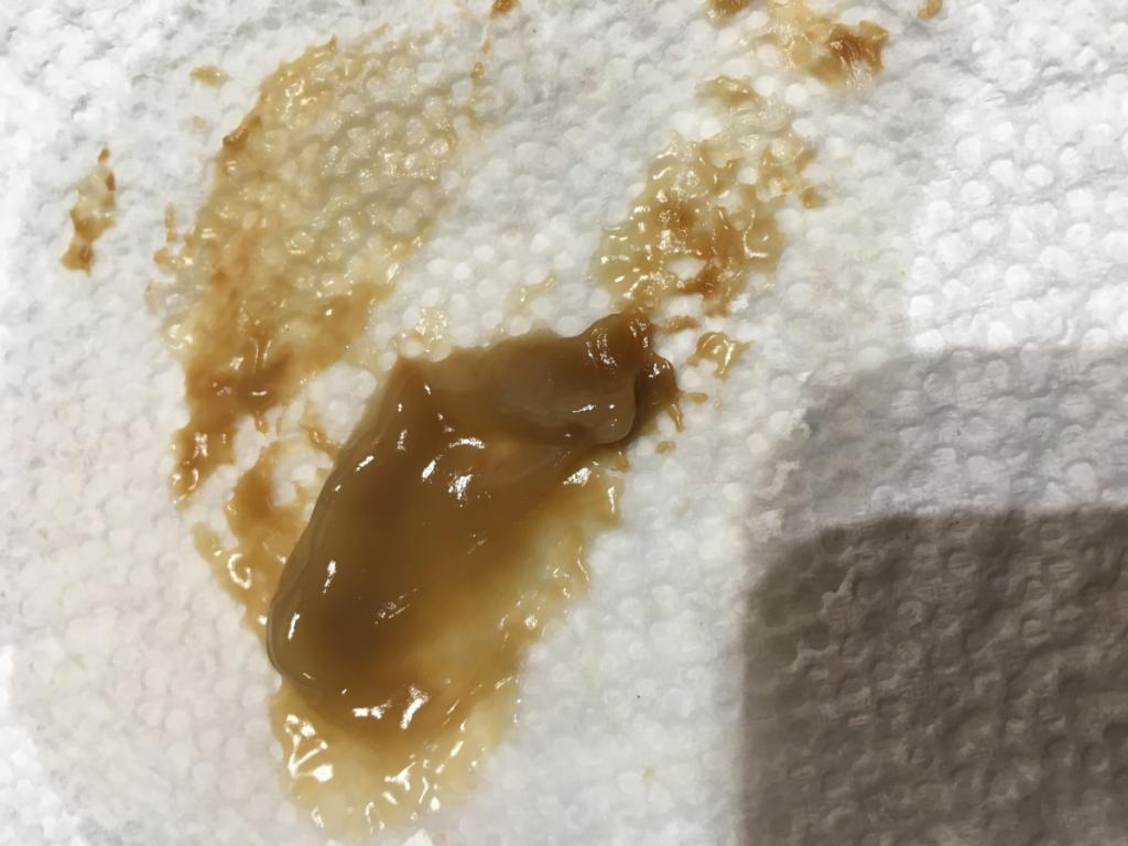 Blockage is one of the common causes.